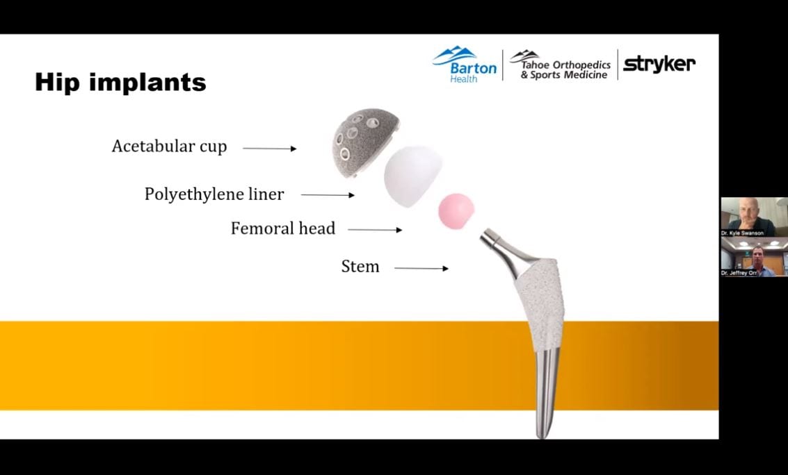 Joint Replacement Webinar Preview