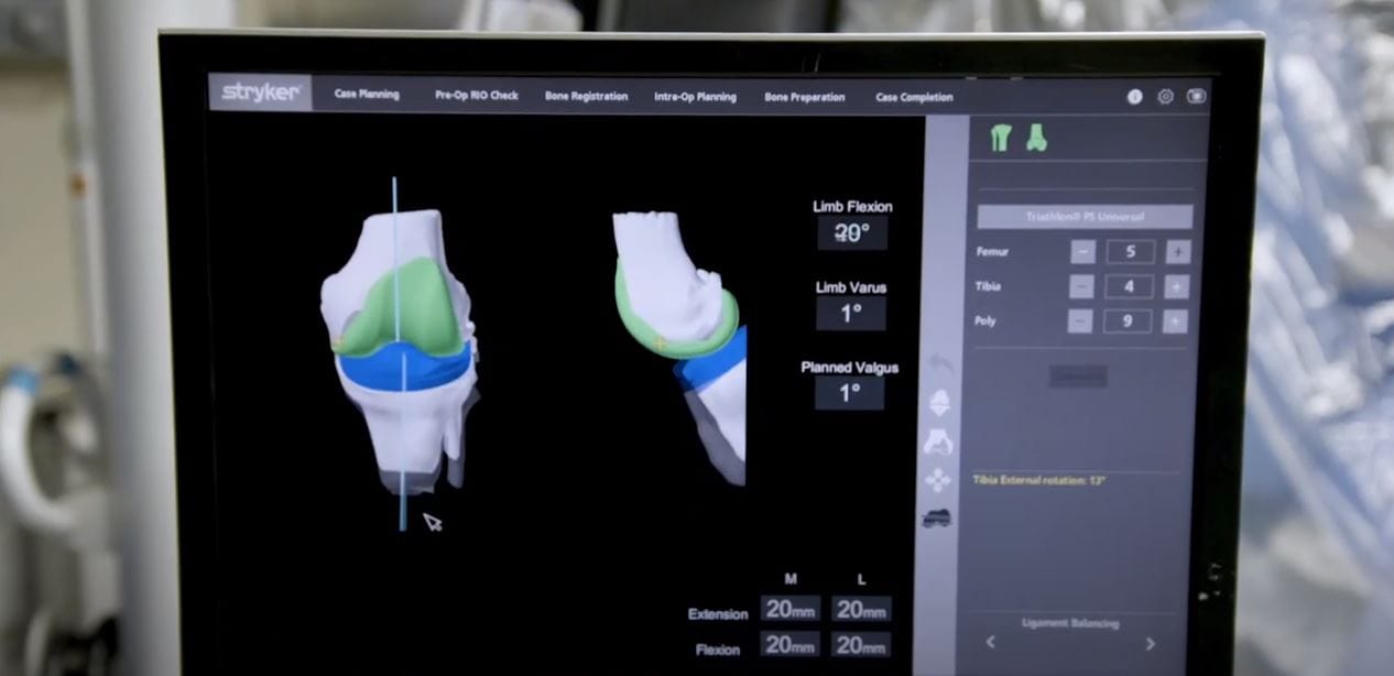 Joint Replacement Video Preview